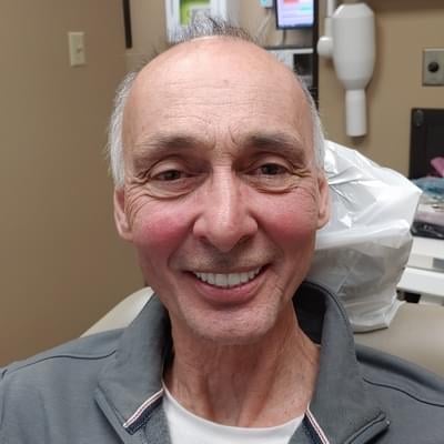 K1 Implant Choice - All on 4 - Full Mouth Dental Implants in one Day